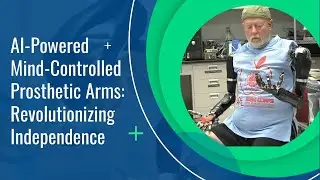 AI-Powered Mind-Controlled Prosthetic Arms: Revolutionizing Independence #shorts  #robot  #science