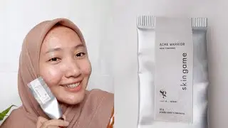 Obat Jerawat yang Selalu Sold Out || Review Skin Game Acne Warrior