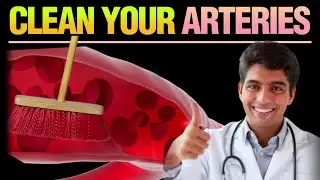 Natural Ways to CLEAR ARTERIAL Calcium and BOOST HEART Health!