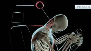 Phoenix Chiropractor | Whiplash Accident Symptoms | Personal Injury Doctor
