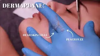 MUST WATCH Full Dermaplaning Treatment | #Skincare #dermaplane #dermaplaningfacial