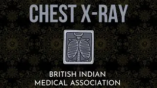 Chest X-Ray - Clinical Crash Course | British Indian Medical Association (BIMA)