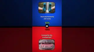 smell like rotten eggs or? 😂🧐 #choicechampionmaster #wouldyourather #whatwouldyourather #quiz