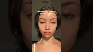 nobody&rsquo;s skin is perfect🫶