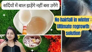 Winter में No Hairfall No Baldness | World's Fastest Hairfall and Baldness Remedy #winterhaircare