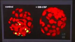 Scientists make IVF breakthrough