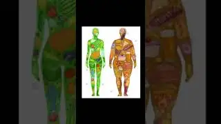 #digestivehealth #guthealth #motivation #digestivewellness #gutbiome #gutissues #doctor #healthygut