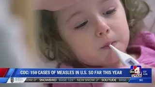 159 cases of measles in US in 2019