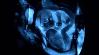 Zwillingbabys in Mamas Bauch gefilmt mit MRT Neuste Technik 2012
