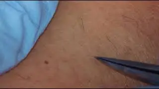 Microscopy Electrolysis