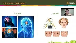 S&iacute;ndrome De Foville Alejandro Mart&iacute;nez