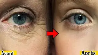 Un secret japonais pour &eacute;liminer les rides des yeux et du visage en une semaine une recette &eacute;prouv&eacute;e