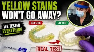 How to Remove Yellow Stains From Your Mouthguard | Sentinel Mouthguards