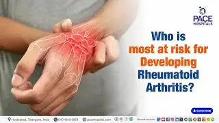 Who Is at Risk for Rheumatoid Arthritis? | Risk Population of Rheumatoid Arthritis #arthritis