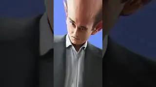 Akshaye Khanna's condition due to baldness #shortvideo