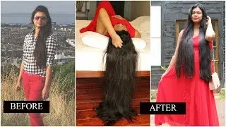 Hair loss: Causes, Symptoms and Treatments using Home Remedies|Sushmita's Diaries