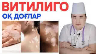 ТЕРИДАГИ ОҚ ДОҒЛАР ВИТИЛИГО ҲАҚИДА, САБАБЛАРИ, БЕЛГИСИ, ДАВО ЧОРАЛАРИ