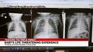 Northeast Ohio mom shares baby&rsquo;s life-threatening experience with RSV