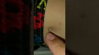 belly button play while asleep