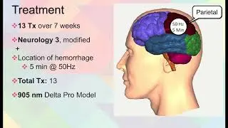 coMra Medical Case Study: Brain injury following car accident