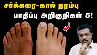 கால் நரம்பு பாதிப்பை காட்டும் 5 அறிகுறிகள் ! Diabetes tips in Tamil