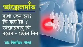 আক্কেল দাঁত নিয়ে সকল সমস্যার সমাধান | How to prevent Wisdom Teeth problem