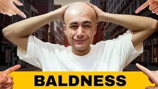 Baldness - Men's Biggest Fear