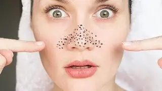 HIDUNG BEBAS KOMEDO SEKETIKA CUMAN 2 LANGKAH SEDERHANA TANPA RASA SAKIT