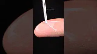 Smooth Peeling