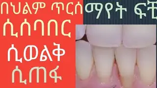 በህልም ጥርሰ ሲሰባበር ሲወድቅ ሲጠፋ ማየት ፍቺ።#deram #podcast #abelbirhanuየወይኗልጅ