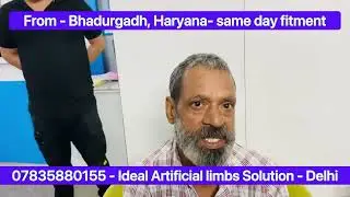 Artificial Limb07835880155 any age any level of amputation can be treated in same day