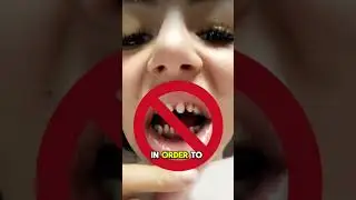 The Truth About Porcelain Veneers Revealed