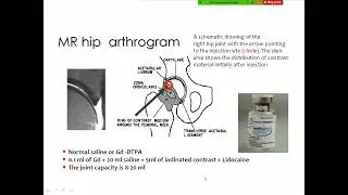 1  Introduction to MSK Imaging Physical principles of musculoskeletal MRI    HD