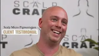 Client Testimonial - Scalp Micropigmentation. The Ultimate Hair Loss Tattoo