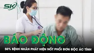 50% Bệnh Nhân Nốt Phổi Đơn Độc Ác Tính Được Tình Cờ Phát Hiện | SKĐS