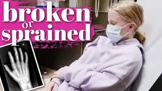 У ДОЧЕРИ СЛОМАН ИЛИ ВЫВЯЗАНА РУКА? | НЕОТЛОЖНАЯ ПОМОЩЬ ПРИ РЕНТГЕНОВСКОМ СНИМКЕ РУКИ ДОЧЕРИ | СЛОМАН ИЛИ ВЫВЯЗАНА?