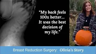 Breast Reduction Surgery | Olivia's Story
