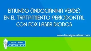 Laser Dental Diodo A.R.C. FOX con EmunDo (indocianina verde) en terapia periodontal