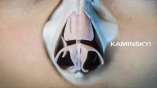 3D animation: Polygon concept Tip plasty. Preservation rhinoplasty  ⭕️ KAMINSKYI