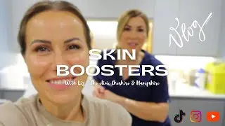 Skin Booster Treatment «Seventy Hyal» | уход за кожей | видеоблог с обзором косметических процеду...