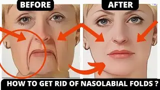No Fillers! Face Yoga for Laugh Line, Frown Lines, Forehead Lines | Lift Smile LInes in 2 Weeks!