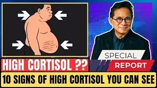 High Cortisol 10 Signs of High Cortisol You Can See | ReAge
