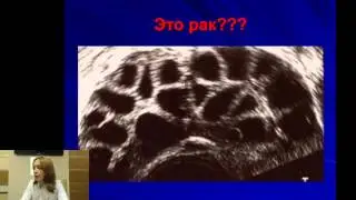 17 06 2014 СГЯ, возможности предотвращения