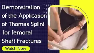Demonstration of the Application of Thomas Splint for Femoral Shaft Fractures | Orthopaedic