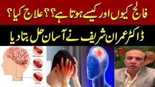 Why Stroke Happens & How to Treat It | Dr. Imran Sharif Explains Simple Cure  | Pakistan News
