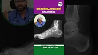 Reasons for Heel Pain | Heel Pain Causes and Treatment | One Hospitals | #shorts #heelpain