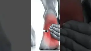 Con estos consejos mejorar&aacute; tu fascitis plantar #drclip #fascitisplantar
