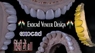 veneer design exocad HINDI & exocad bridge design, exocad smile design,