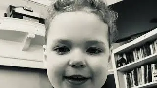 Ruby smile