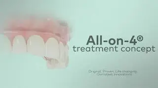 All-on-4&reg; treatment concept &ndash; A minimally invasive solution with a fixed full-arch restoration